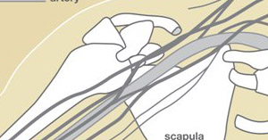 Brachial Plexus Injury: Signs & Treatment | The Hand Society