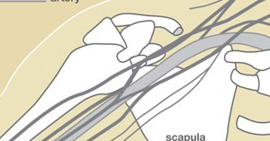 Brachial Plexus Injury: Signs & Treatment | The Hand Society