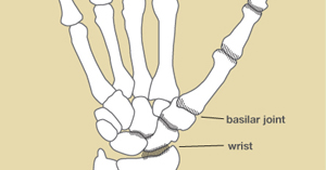 ízületi brachialis artrosis