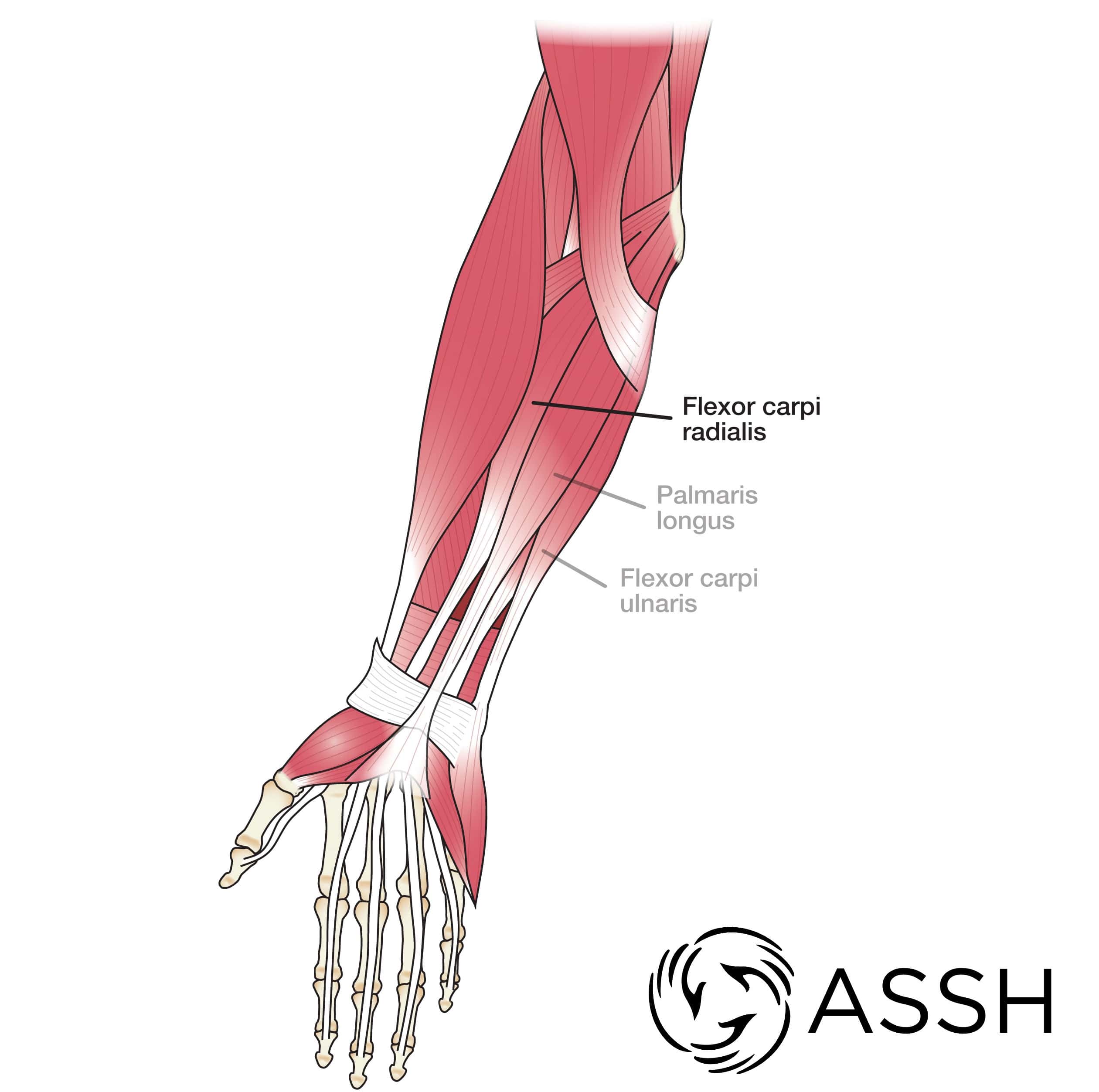 Forearm and wrist online