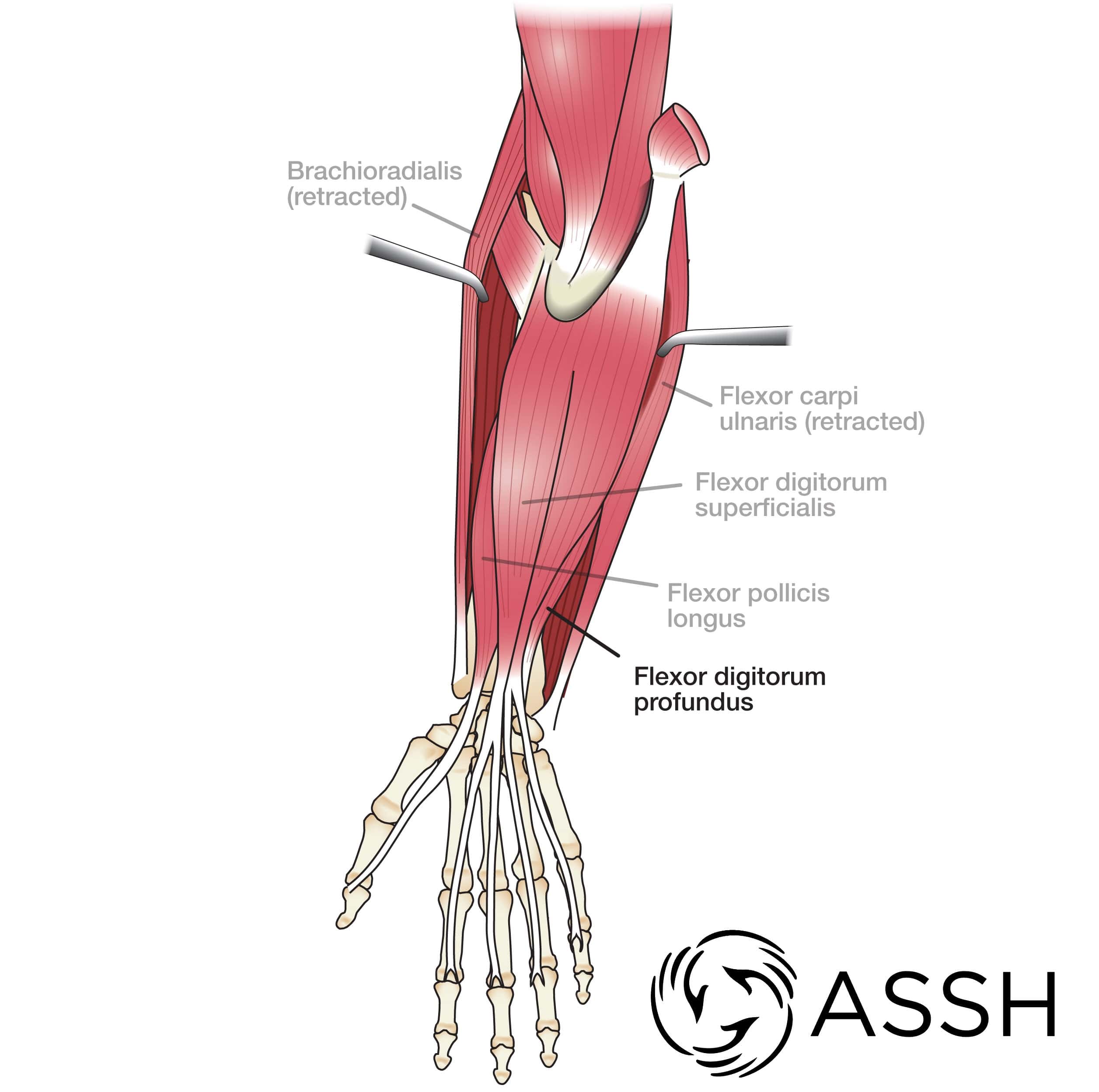 Tendons shop in arm