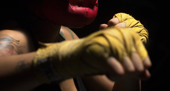 4 Signs of a Boxer’s Fracture