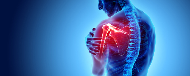 3 Types of Shoulder Fractures