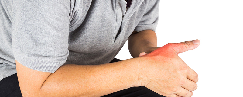 5 Signs of a Thumb Sprain