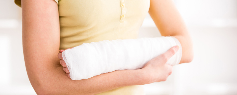 How to take care of your arm cast