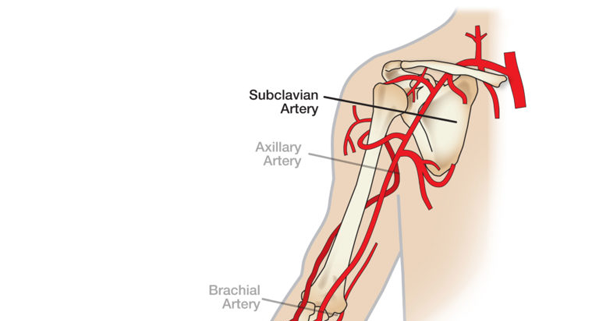 Anatomy 101: Arteries of the Arm | The Hand Society