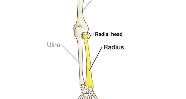 Advice from a CHT: Radial Head Fractures | The Hand Society