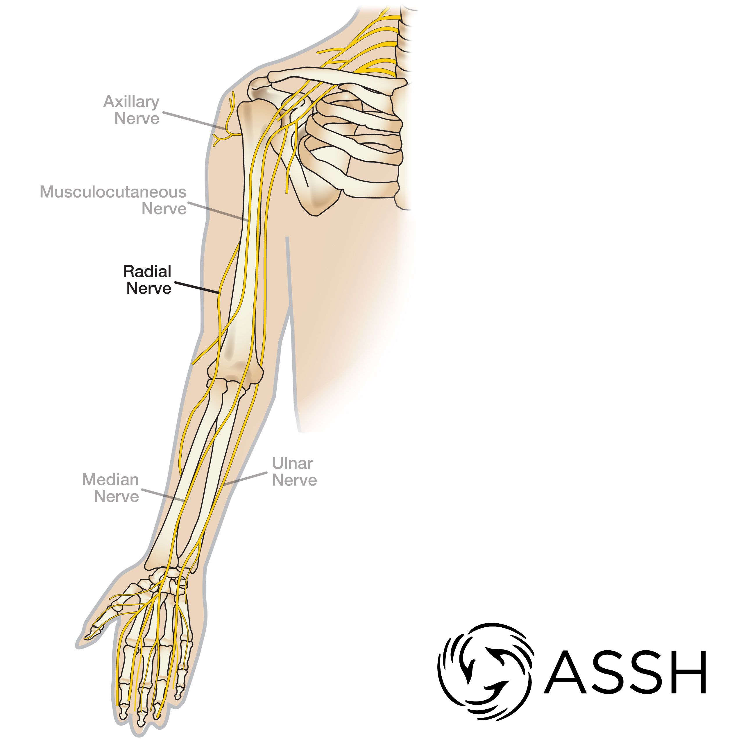 Radial Tunnel Syndrome What Is It Symptoms Causes Diagnosis