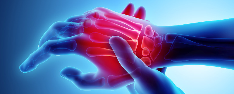 Treating Hand Arthritis Without Surgery
