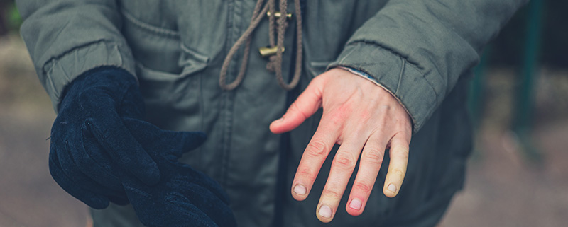 Advice from a Certified Hand Therapist: What is Raynaud's Disease?