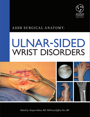 Pain in ulnar side of wrist deals